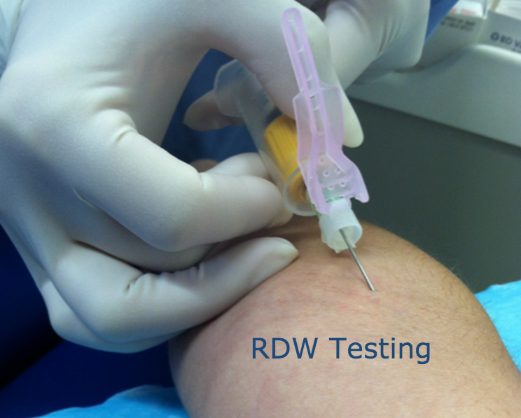 RDW testing